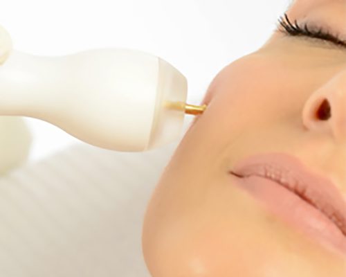 Elettroporazione Plasmatec